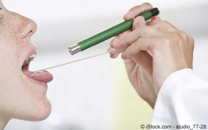 Weiße stippchen auf den mandeln